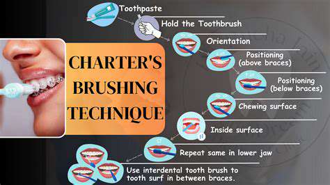 TheBrushingProcess:Step-by-Step