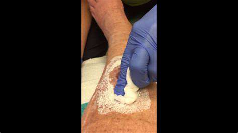 CleaningtheWoundThoroughly